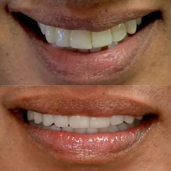 Smile Gallery