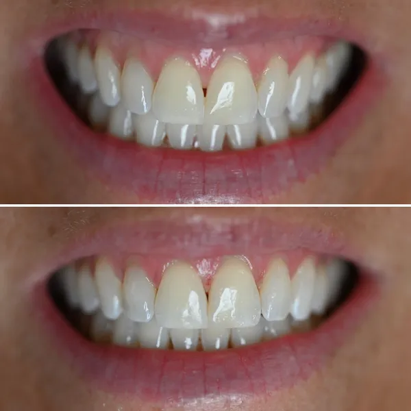 Smile Gallery