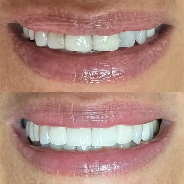 Smile Gallery