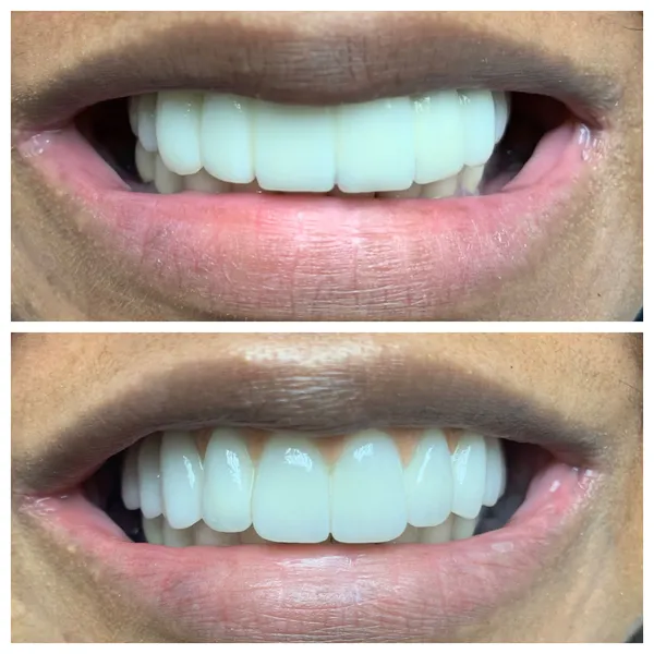 Smile Gallery