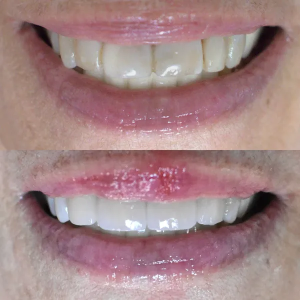 Smile Gallery