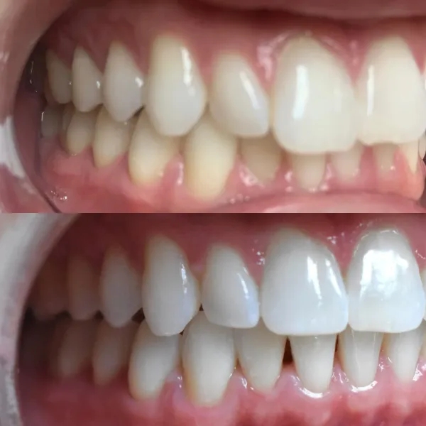 Smile Gallery