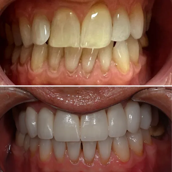 Smile Gallery