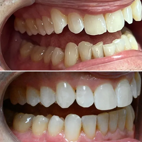 Smile Gallery