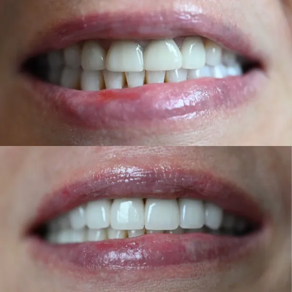 Smile Gallery