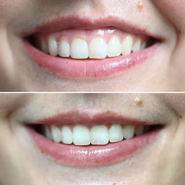 Smile Gallery