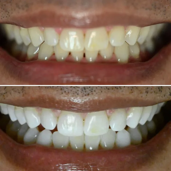 Smile Gallery