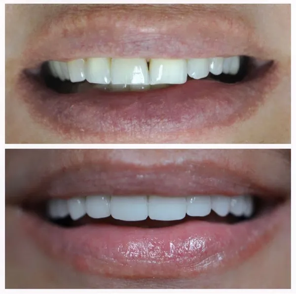 Smile Gallery