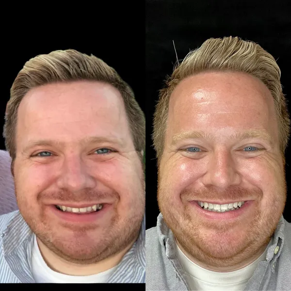 Smile Gallery